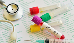 4 Reasons Why You Should Get Tested For HIV